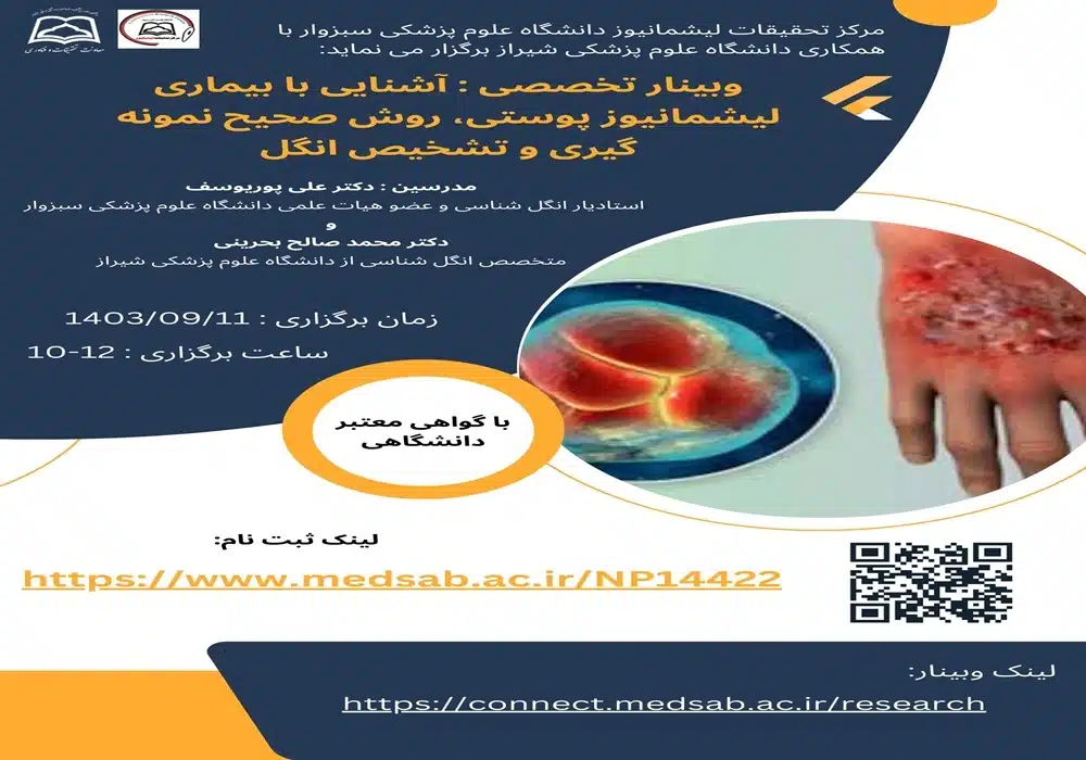 بیماری لیشمانیوز